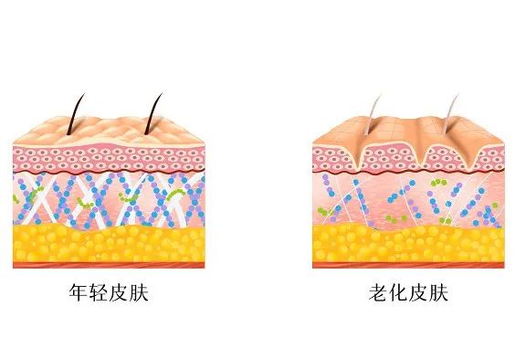 外阴白斑患者为什么要戒糖？