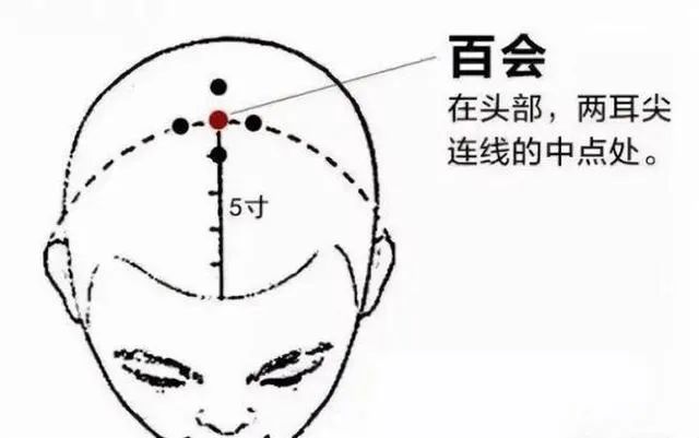 外阴白斑患者在冬天应该怎么养生？