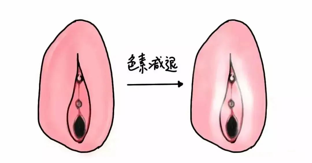 外阴瘙痒会是外阴营养不良吗？